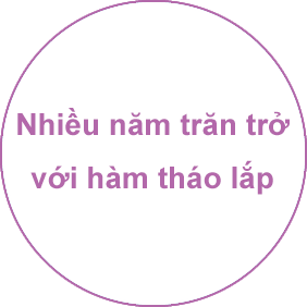 Nhiều năm trăn trở với hàm tháo lắp 