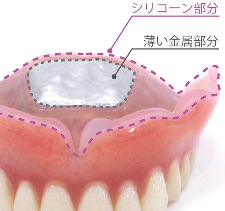 金属を使用した丈夫で違和感を緩和する快適設計