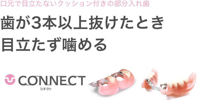 口元で目立たないクッション付きの部分入れ歯。歯が3本以上抜けたとき、目立たず噛める