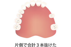 コネクトS適用例02