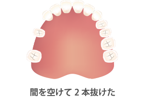 ソケット適用例02