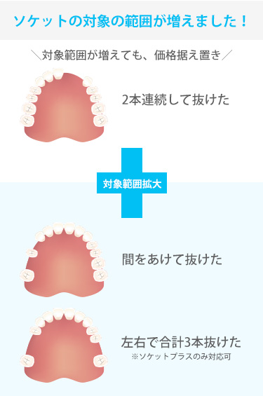 ソケットの症例拡大しました