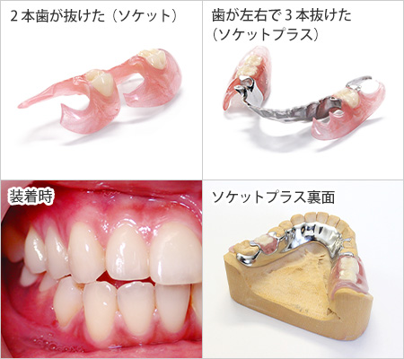 最短たった2回のご通院で完成する手軽さ