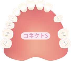 間を空けて2本抜けた