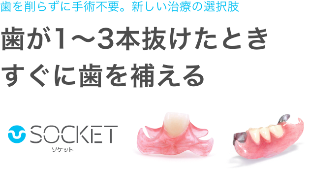 歯が1〜3本抜けた時に噛める部分入れ歯ソケット