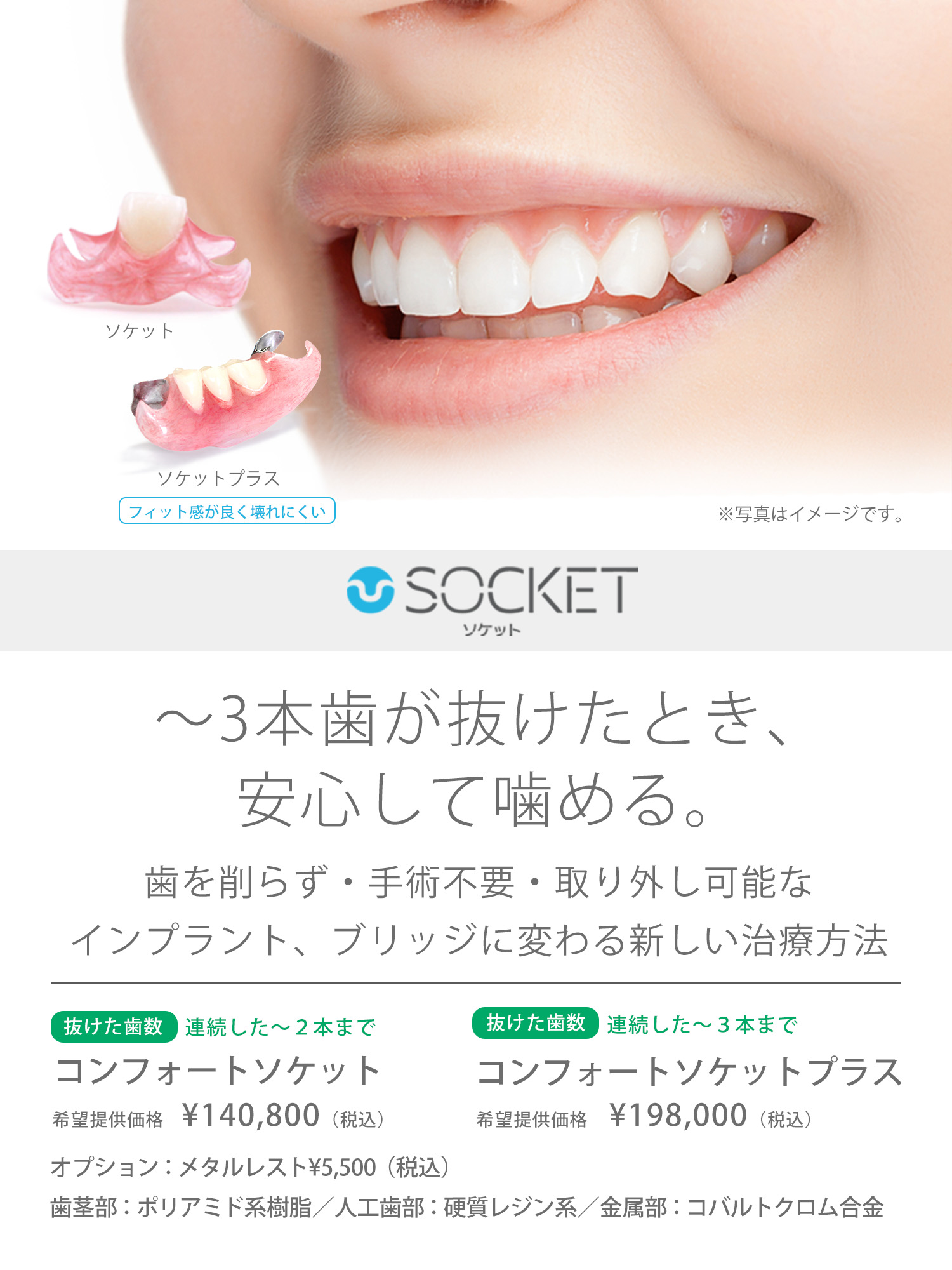 インプラント ブリッジに代わる新しい選択肢コンフォート