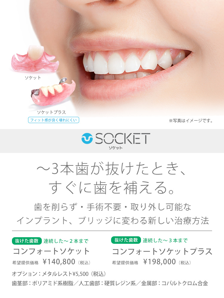歯が1〜3本抜けた時に噛める部分入れ歯ソケット