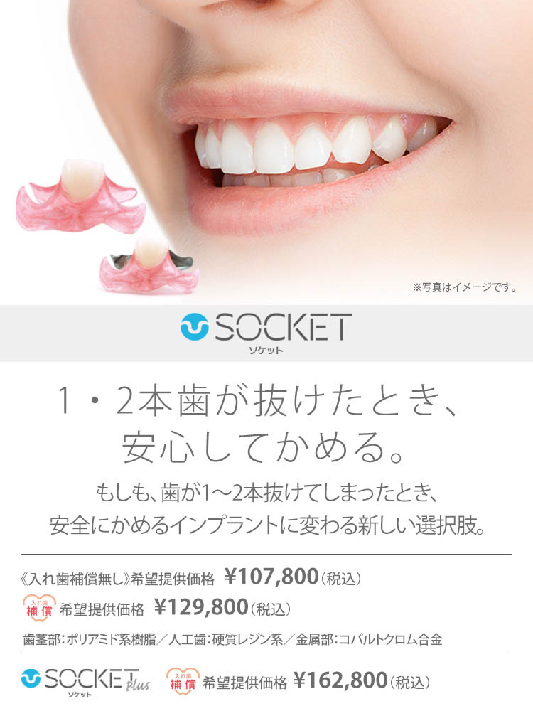Socket インプラント ブリッジに代わる新しい入れ歯の選択肢コンフォート Socket インプラント ブリッジに代わる新しい入れ歯の選択肢コンフォート